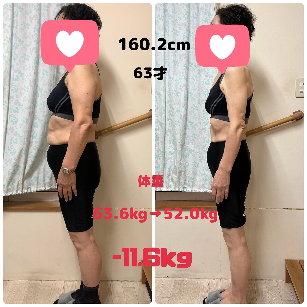 63歳 -11.6kg 美姿勢のビフォーアフター